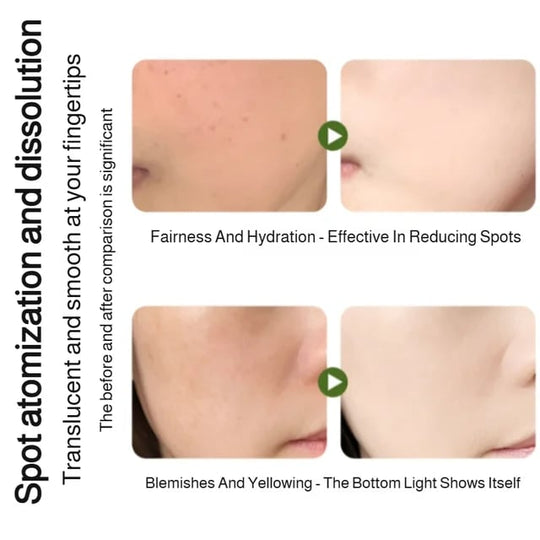 Spray de albire hidratanta esenta