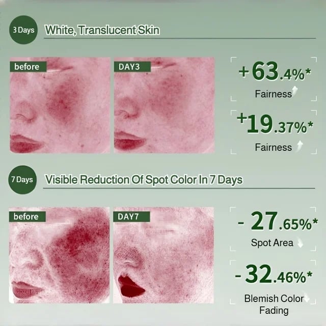 Spray de albire hidratanta esenta