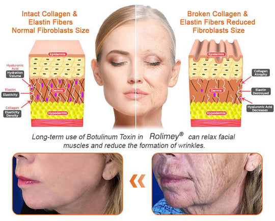 🧑‍⚕️𝑶𝒇𝒇𝒊𝒄𝒊𝒂𝒍 𝑺𝒕𝒐𝒓𝒆 | 𝐑𝐨𝐥𝐢𝐦𝐞𝐲® Botox Bee Venom Firming Serum Stick - Targets Sagging Skin & Wrinkles All Over Body with Advanced Peptide Technology, Visible Results in 3 Days (⏳LAST DAY 40% OFF)