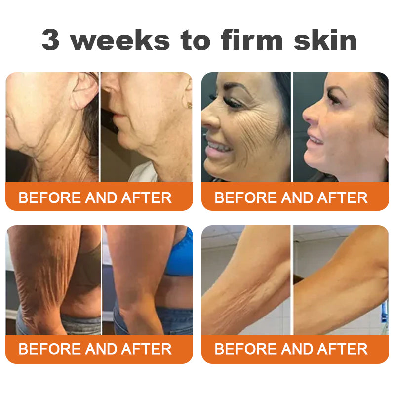 🧑‍⚕️𝑶𝒇𝒇𝒊𝒄𝒊𝒂𝒍 𝑺𝒕𝒐𝒓𝒆 | 𝐑𝐨𝐥𝐢𝐦𝐞𝐲® Botox Bee Venom Firming Serum Stick - Targets Sagging Skin & Wrinkles All Over Body with Advanced Peptide Technology, Visible Results in 3 Days (⏳LAST DAY 40% OFF)