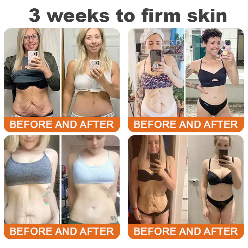 🧑‍⚕️𝑶𝒇𝒇𝒊𝒄𝒊𝒂𝒍 𝑺𝒕𝒐𝒓𝒆 | 𝐑𝐨𝐥𝐢𝐦𝐞𝐲® Botox Bee Venom Firming Serum Stick - Targets Sagging Skin & Wrinkles All Over Body with Advanced Peptide Technology, Visible Results in 3 Days (⏳LAST DAY 40% OFF)