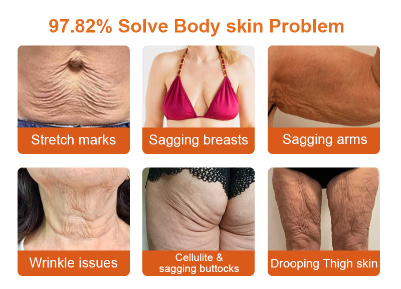 🧑‍⚕️𝑶𝒇𝒇𝒊𝒄𝒊𝒂𝒍 𝑺𝒕𝒐𝒓𝒆 | 𝐑𝐨𝐥𝐢𝐦𝐞𝐲® Botox Bee Venom Firming Serum Stick - Targets Sagging Skin & Wrinkles All Over Body with Advanced Peptide Technology, Visible Results in 3 Days (⏳LAST DAY 40% OFF)