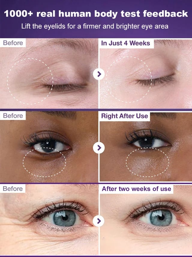 Cremă de ochi fermă antirid-retinol