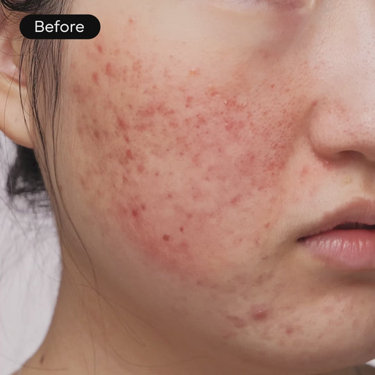 Intensive Cica Repair Cream