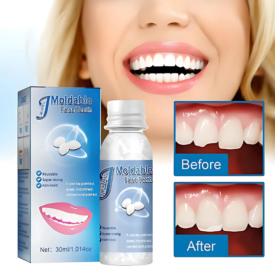 TeethRepair™ 1+1 GRATIS: kit per la riparazione dei denti dall'aspetto naturale