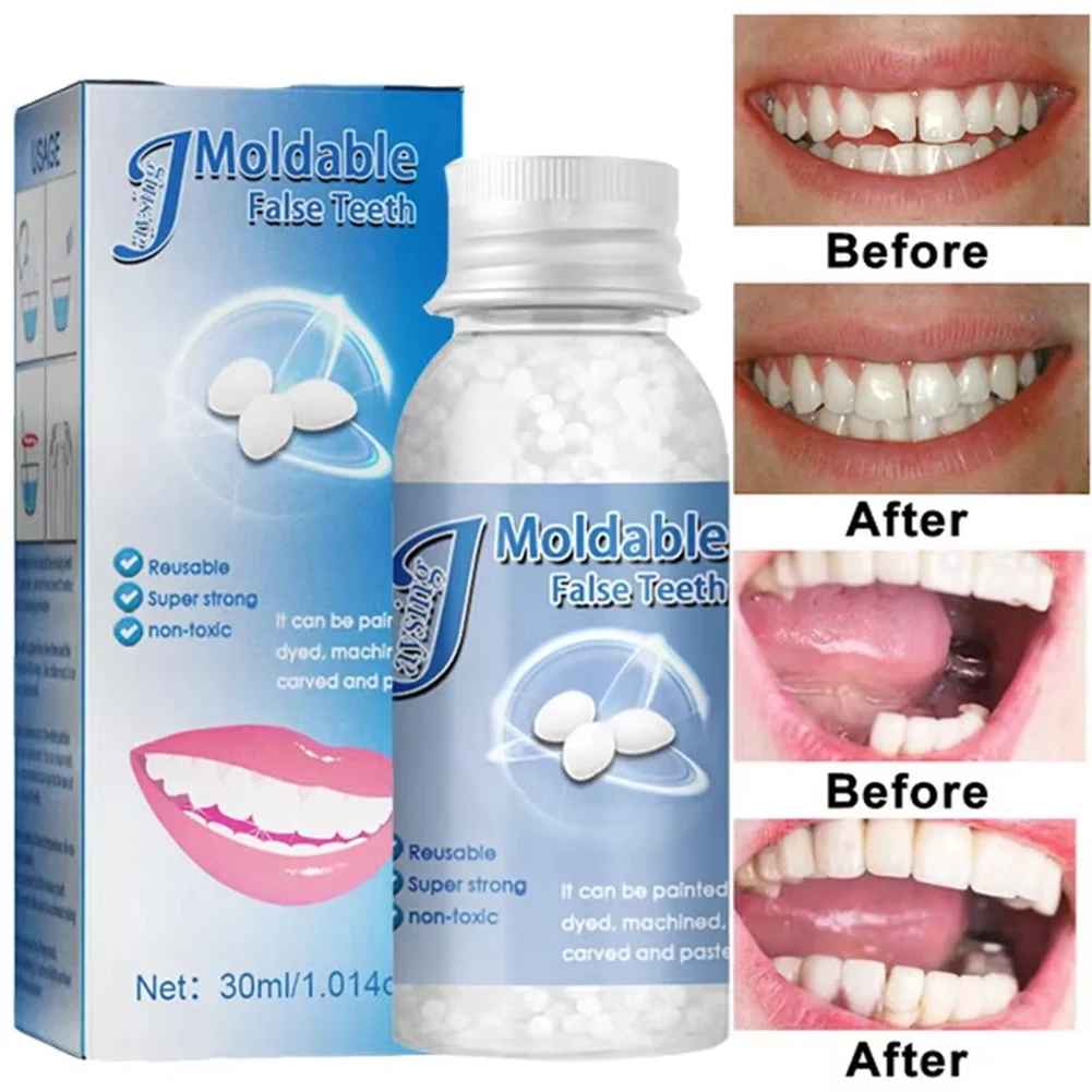 TeethRepair™ 1+1 GRATIS: kit per la riparazione dei denti dall'aspetto naturale