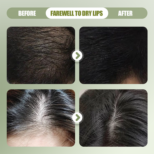 Natural Shampoo Bar For Strengthening Hair