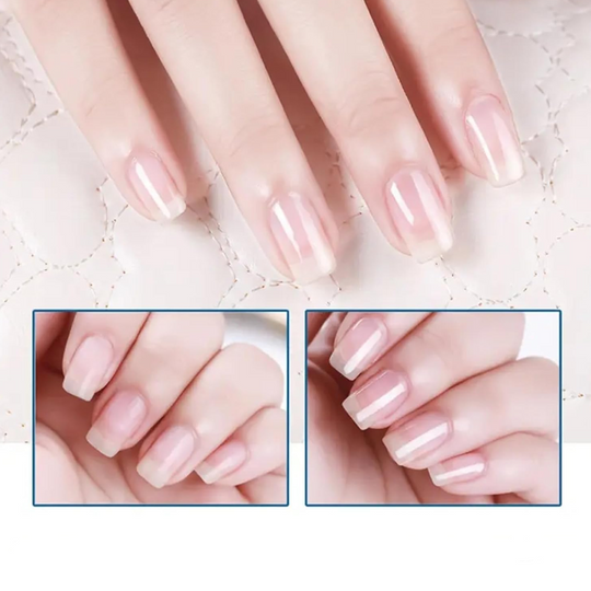 ⏰Buy 2 Get 1 Free! 💅High-Gloss Quick-Dry Nail Oil - Salon-Perfect Shine, Anytime, Anywhere!