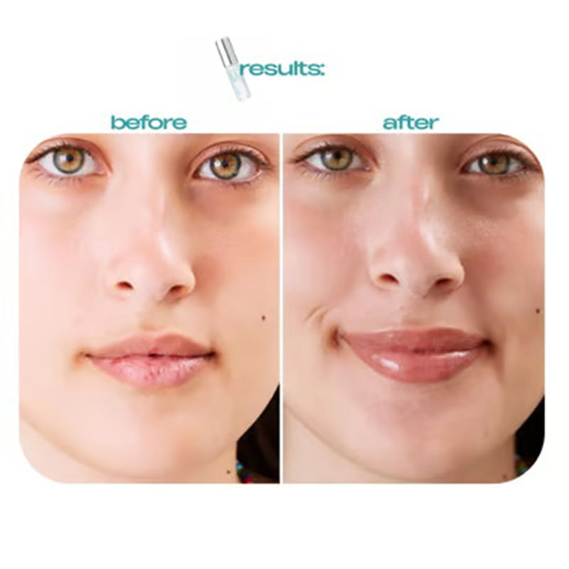 Olio labbra idratante non appiccicoso - Leviga le linee sottili & Riduce la secchezza