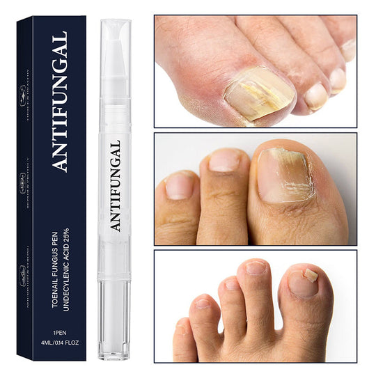 Antifungal Pen - botar de flesta fotsvampar, Jock Itch och ringorm